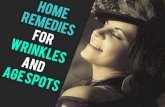 16 Home Remedies for Wrinkles and Age Spots Women Should Know