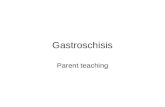 Gastroschisis, parent teaching