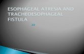 Esophageal Atresia and Tracheoesophageal Fistula