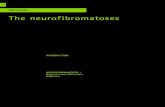 Neuro Fibroma to Ses