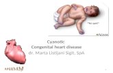 Cyanotic Heart Disease-newllll