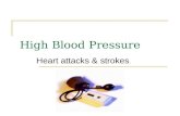 Hypertension High Bloodpressure