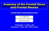 anatomy of frontal sinus & recess