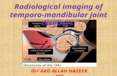 Presentation1.pptx, radiological imaging of temporo mandibular joint diseases.