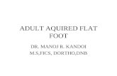 Adult aquired flatfoot