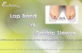 Making Choices: Lap Band Vs. Gastric Sleeve