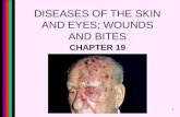 DISEASES OF THE SKIN AND EYES