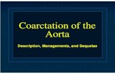 Coarctation+of+the+Aorta+ +Managements+and+Sequelae+ +Dr.+Gord+Mack+ +June+13.2006
