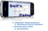 Bell's Palsy