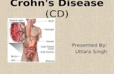 Crohn\'s disease