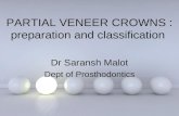 Dr Saransh Malot Partial veneer presentation preparation and classification