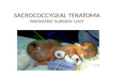 Sacrococcygeal Teratoma -Paediatric Surgery Unit
