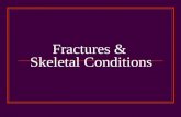 Fractures & Skeletal Conditions