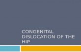 Congenital Dislocation of the Hip Ppt