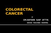 Colorectal  cancer