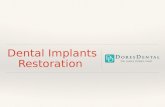Dental Implants Restoration From Our Longmeadow Dentist