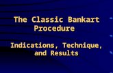 Bankart procedure