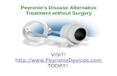 Peyronie’s Disease Alternative Treatment without