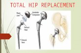 Total hip replacement