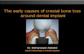 Causes of Crestal Bone Loss Adjacent to implants ...