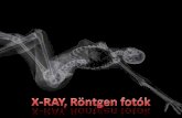 Rtg - X-ray - fotók