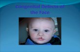 Congenital defects of the Face