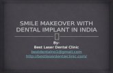 Smile makeover with dental implant in india