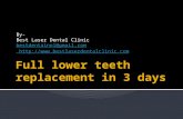 Dental implant for diabetic patients ppt