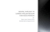 Dental implant in lower molar region for Senior Citizens