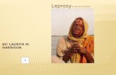 Leprosy power point presentation