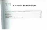 Chp 11 Cerebral Air Embolism