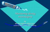 Monitoring during neurosurgery By Dr. Mai Mohsen Abdel Aziz Lecturer of anesthesia, Ain Shams University.
