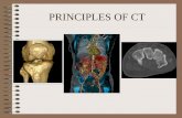 PRINCIPLES OF CT. TOMOGRAPHY TOMOS---SECTION RADIOGRAPHY LIMITATIONS SUPERIMPOSITION DIFFICULTY IN DISTINGUISHING BETWEEN HOMOGENOUS OBJECTS OF NON-UNIFORM.