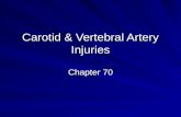 Carotid & Vertebral Artery Injuries Chapter 70. Controversies Pros and cons of duplex versus angiography versus newer modalities Selective versus mandatory.