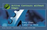 Active Contours without Edges Tony Chan Luminita Vese Peter Horvath – University of Szeged 29/09/2006.