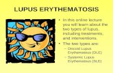 LUPUS ERYTHEMATOSIS In this online lecture you will learn about the two types of lupus, including treatments, and interventions. The two types are: –Discoid.
