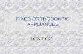 FIXED ORTHODONTIC APPLIANCES DENT 657. Removable vs. Fixed Appliances REMOVABLE n Tipping only n No control over root movement n Pts co-operation n Hygienic.