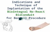 Indications and Technique of Implantation of the BioIntegral No-React BioConduit for Bentall Procedure.