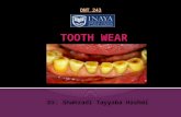 Dr. Shahzadi Tayyaba Hashmi DNT 243. Definition: Tooth wear is defined as loss of tooth tissue due to causes other than caries Types: Physiological (