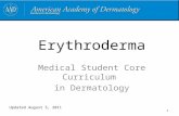 Erythroderma Medical Student Core Curriculum in Dermatology Updated August 5, 2011 1.