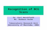 Recognition of BCG Scars Dr. Earl Hershfield Ms. Barbara Roche Tuberculosis Research Unit University of Manitoba, 2004.