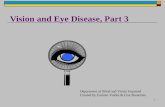 1 Vision and Eye Disease, Part 3 Department of Blind and Vision Impaired Created by Carmen Valdes & Lisa Shearman.