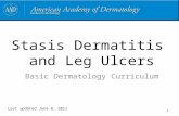 Stasis Dermatitis and Leg Ulcers Basic Dermatology Curriculum Last updated June 8, 2011 1.