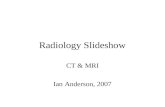 Radiology Slideshow CT & MRI Ian Anderson, 2007. A brief note on CT & MRI scans CT is the initial investigation of choice for suspected intracranial haemorrhage.