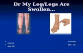 Dr My Leg/Legs Are Swollen… Dr Rashmi Gaekwad RDH 20 th April 2011.
