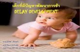 Delay Development