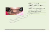 Thyroid Nodule and its management