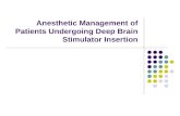 Anesthetic Management of Patients Undergoing Deep Brain Stimulator Insertion.