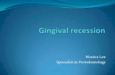gingival recession