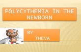 polycythemia in newborn